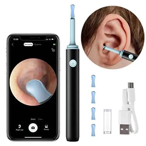 Smart Ear Cleaner with Camera & LED Light – Wireless Ear Wax Removal Tool, High-Precision Ear Cleaning Kit (Random Color)